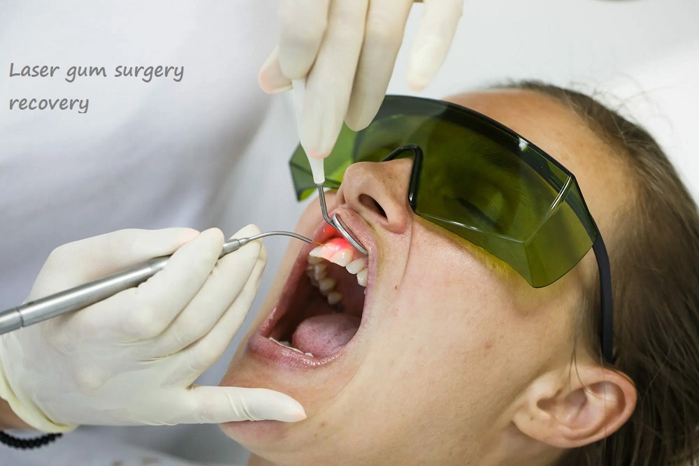 laser gum surgery recovery