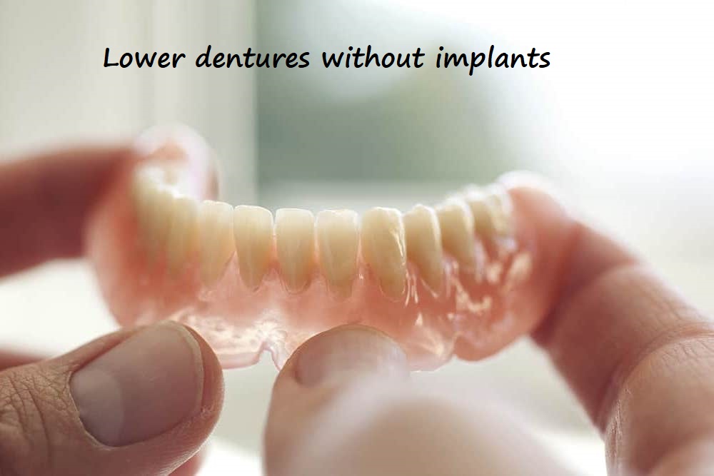 lower dentures without implants