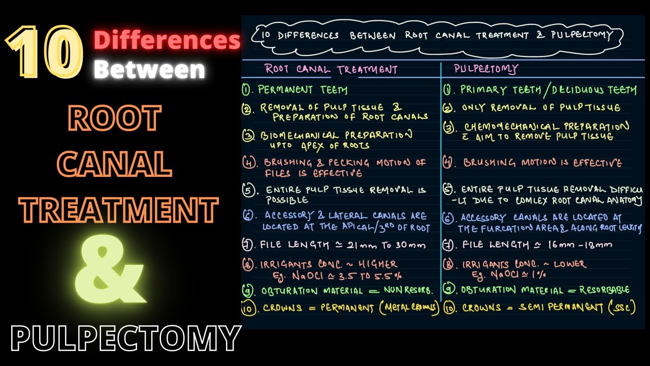 Pulpectomy vs Root Canal