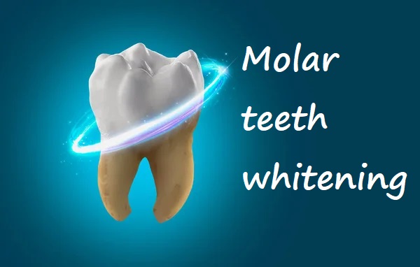 molar teeth whitening