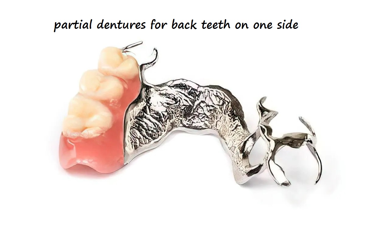 partial dentures for back teeth on one side