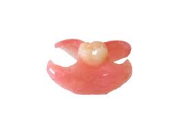 removable partial denture single tooth