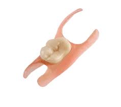 removable partial denture single tooth