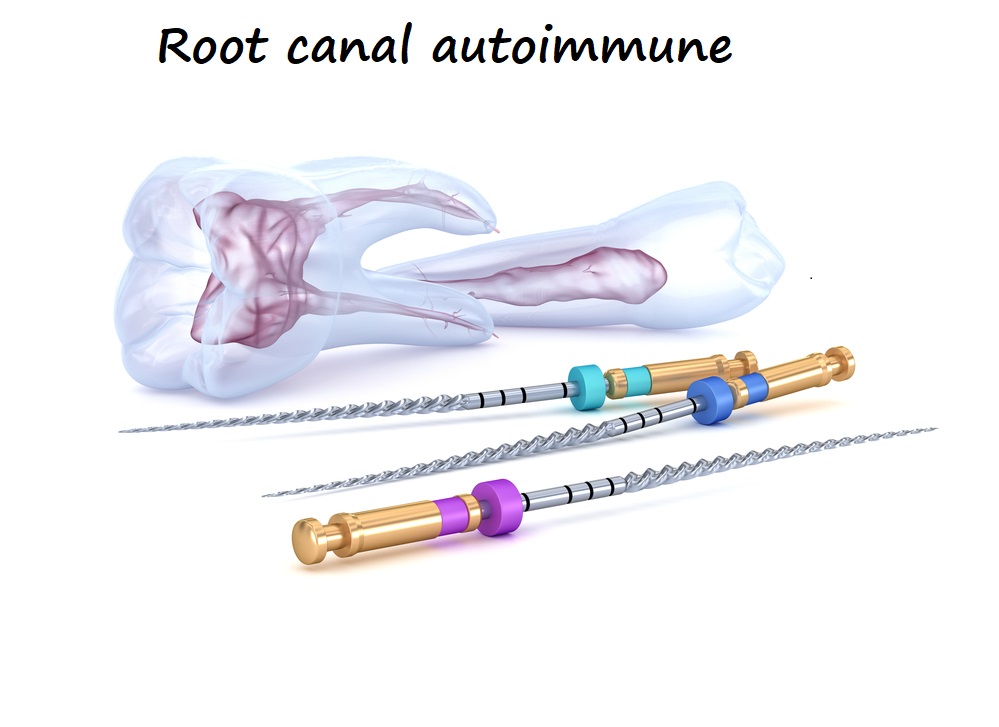 root canal autoimmune