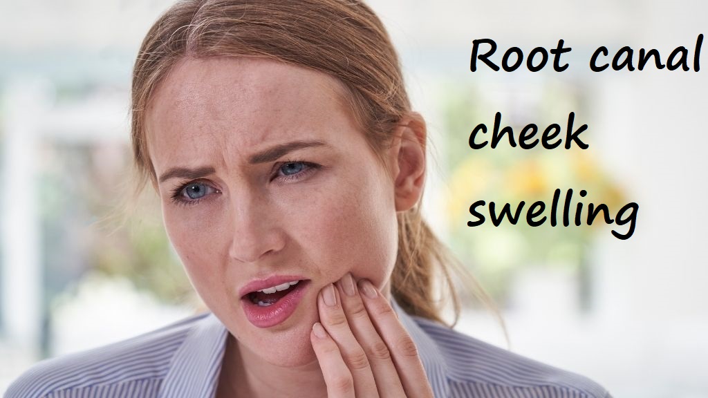 root canal cheek swelling