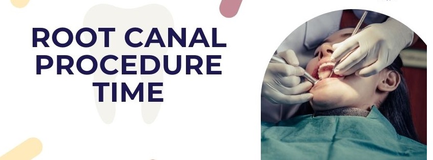 How Long is a Root Canal Procedure