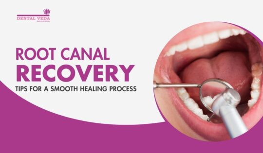Root Canal Recovery Tips