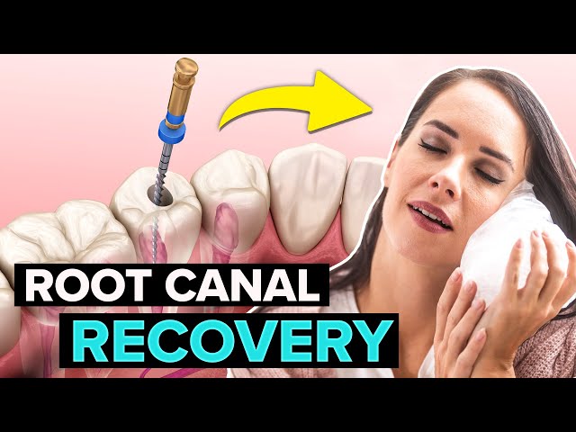 Root Canal Recovery