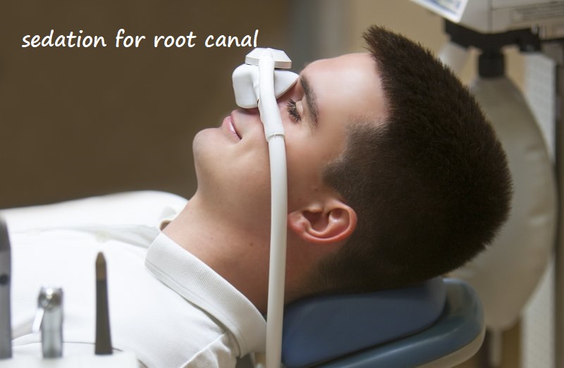 sedation for root canal