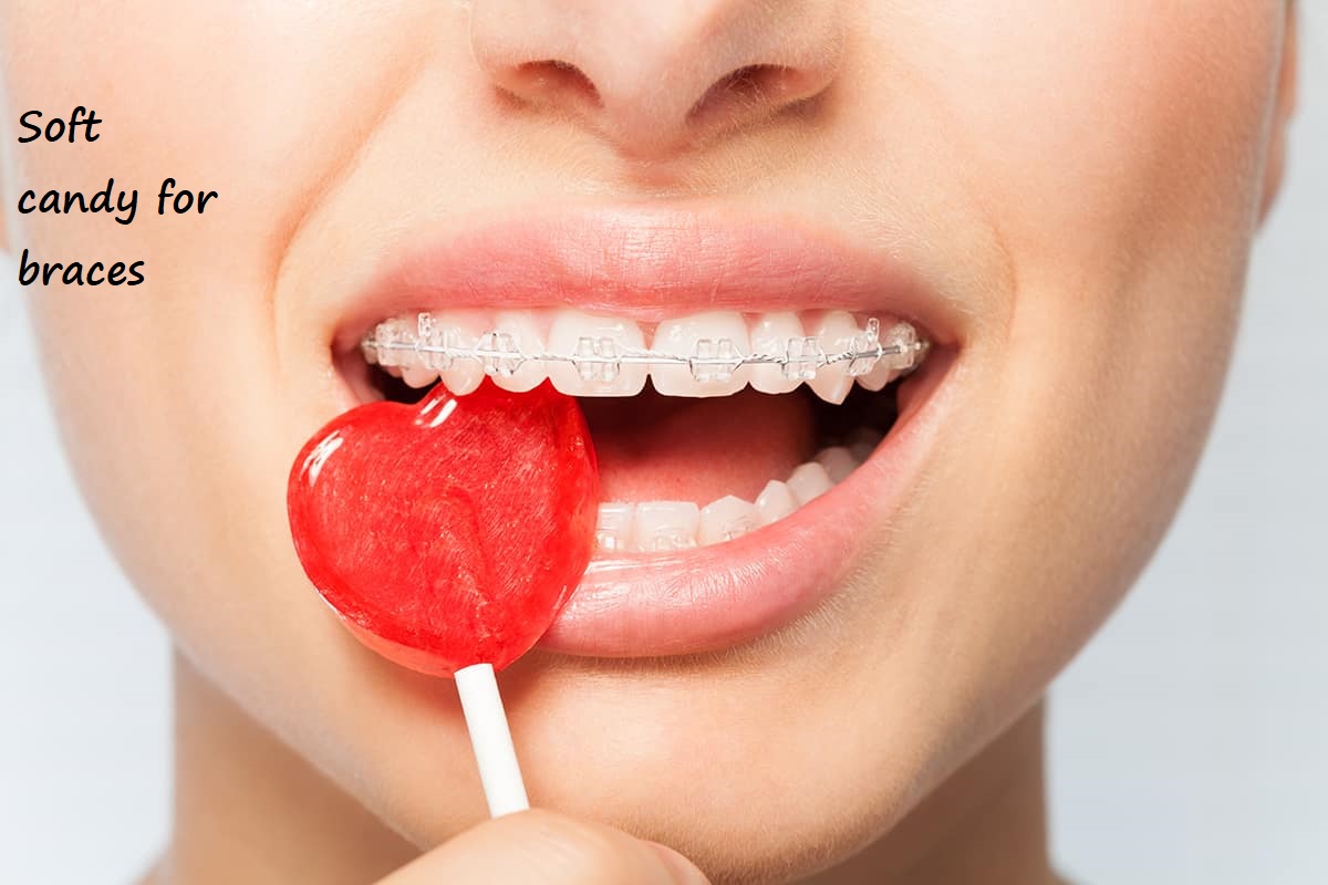 soft candy for braces