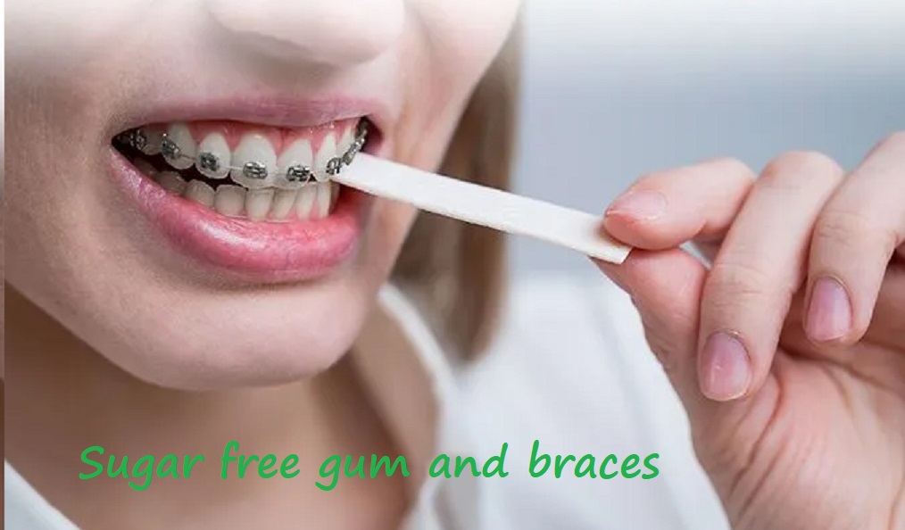 sugar free gum and braces