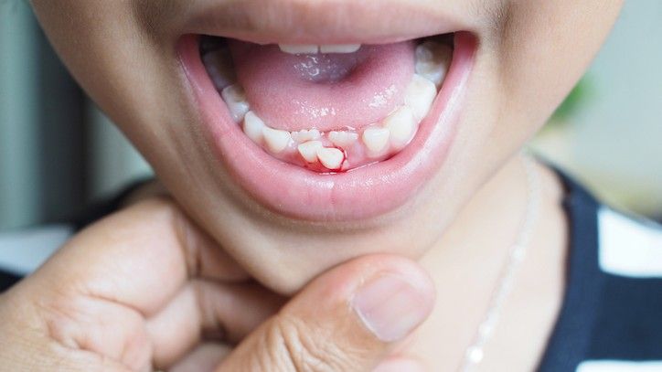 toddler bleeding gums