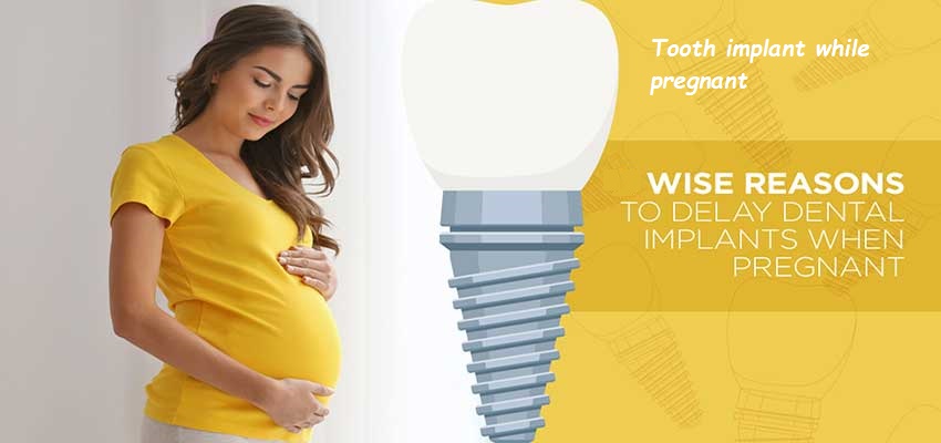 Tooth implant while pregnant