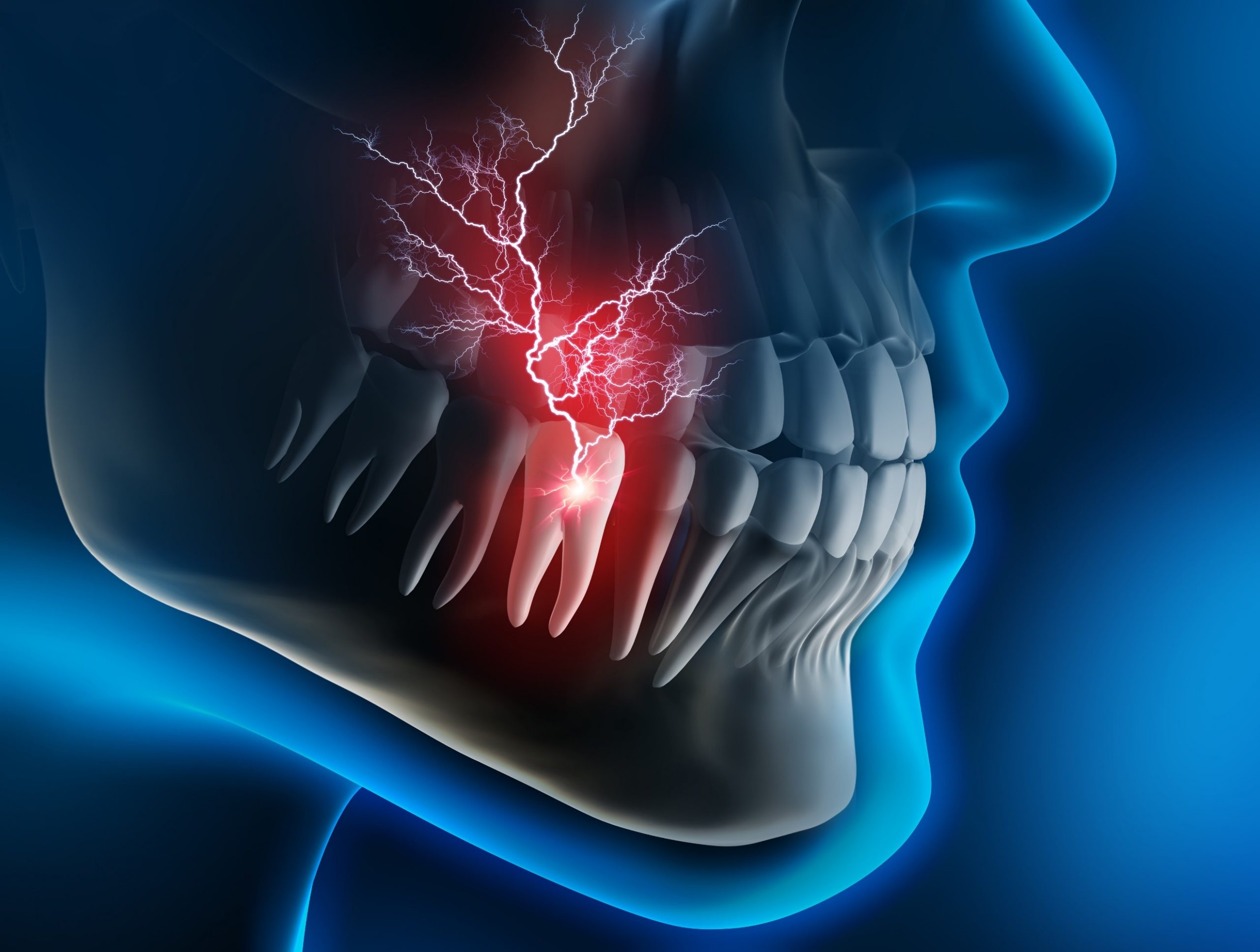 tooth pain under crown comes and goes