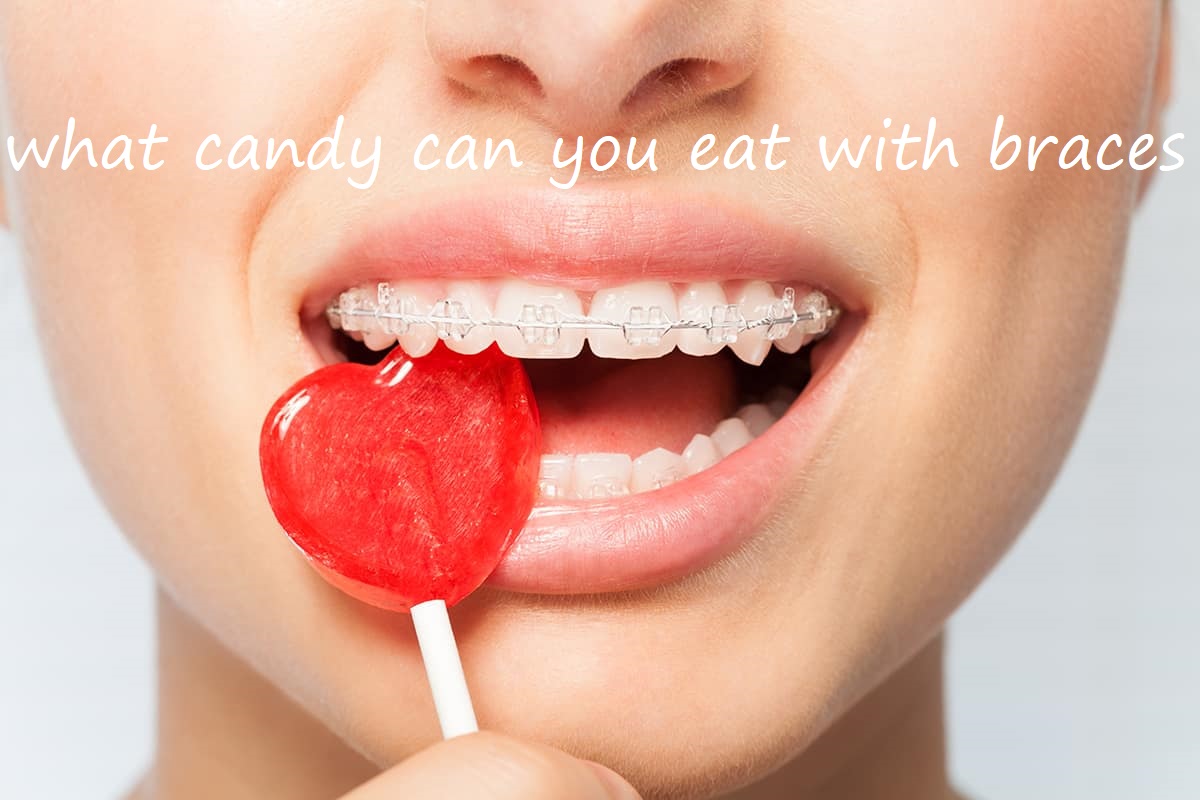 what candy can you eat with braces