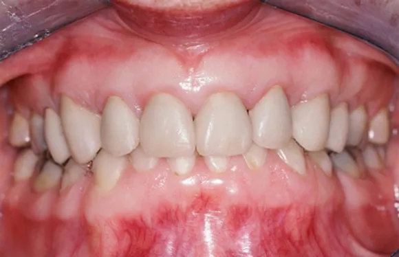 what do healthy gums look like