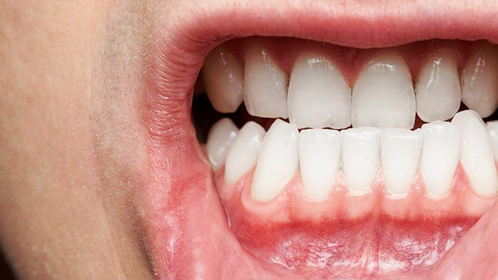 what do healthy gums look like