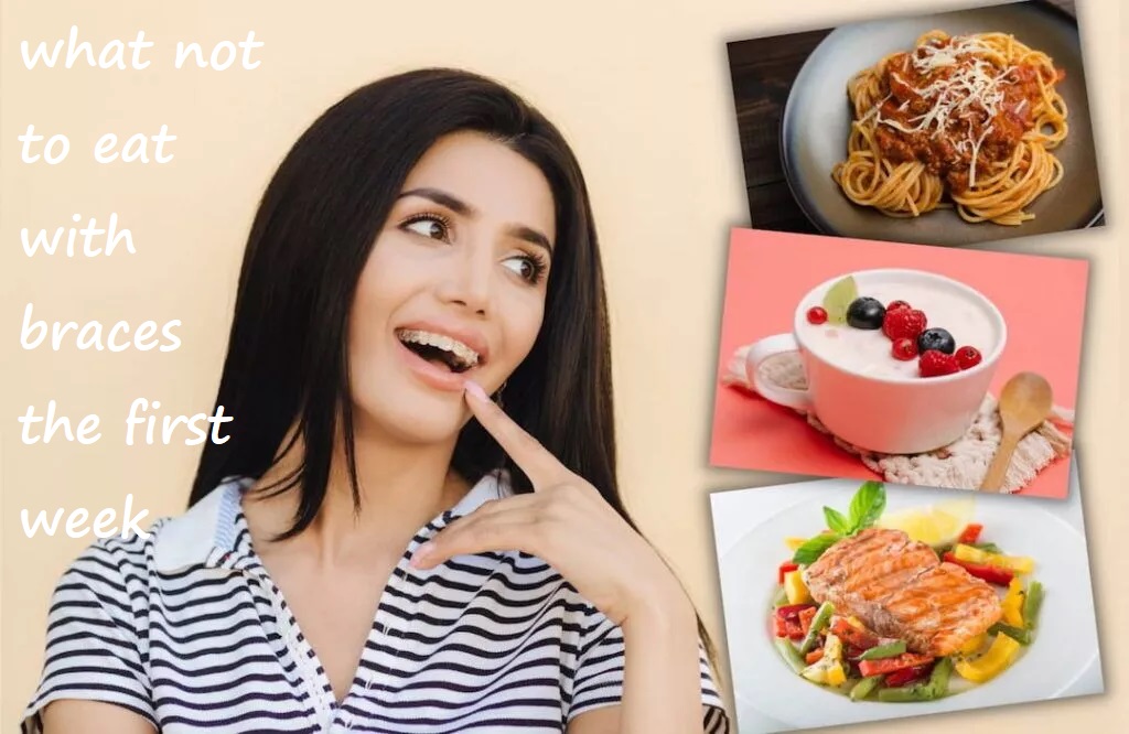 what not to eat with braces the first week