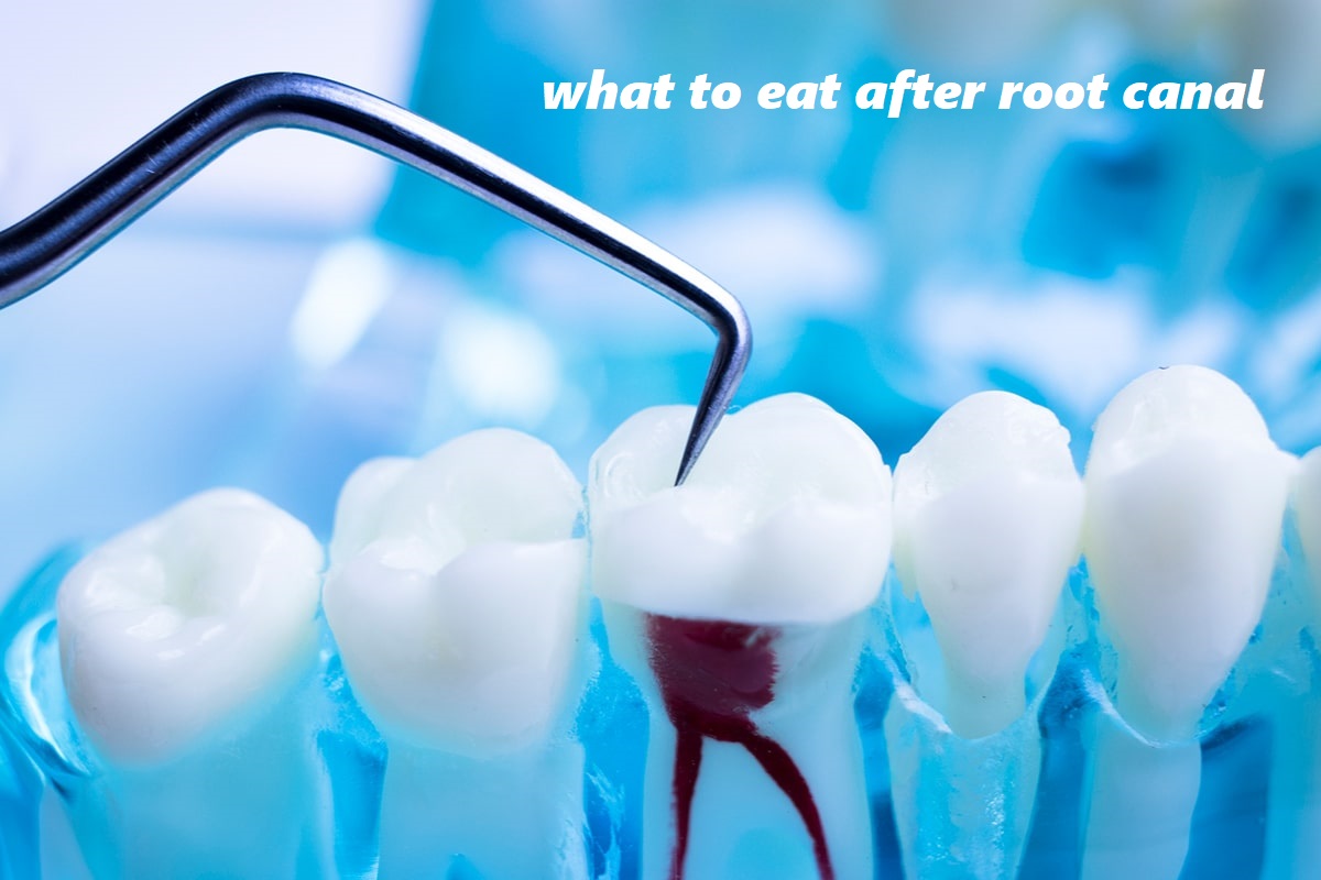 what to eat after root canal