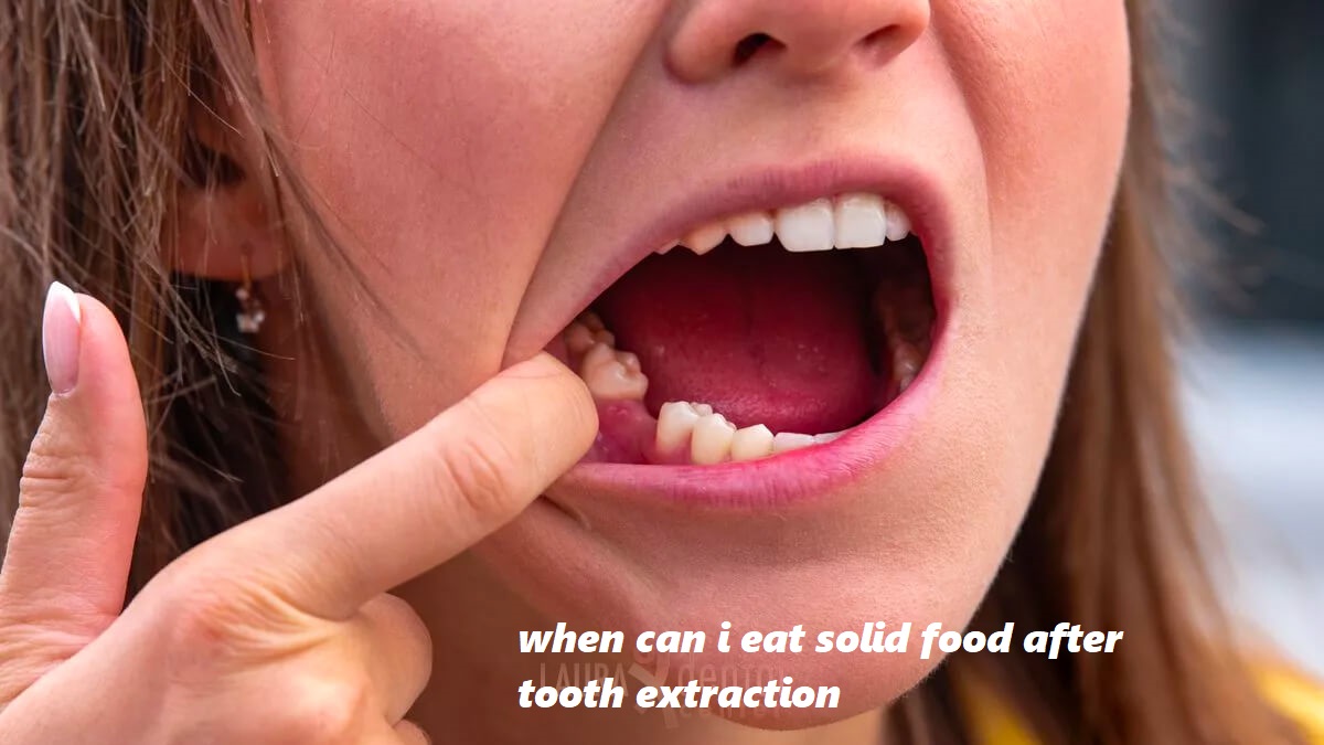 when can i eat solid food after tooth extraction