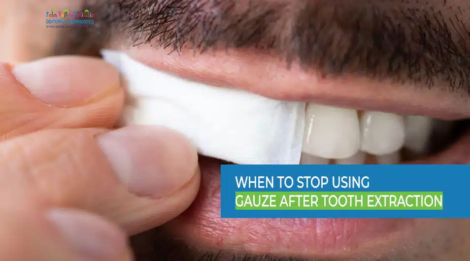 when to stop using gauze after tooth extraction