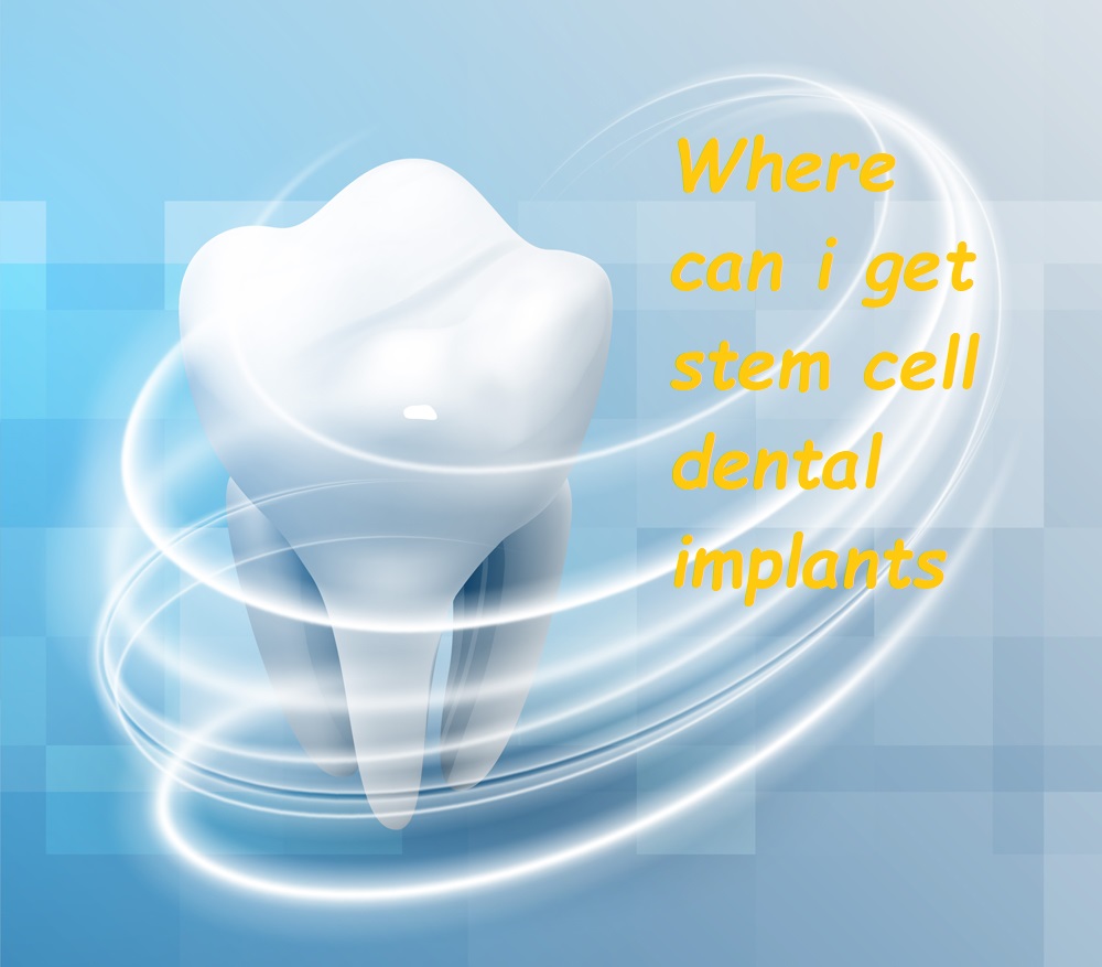 Where can i get stem cell dental implants