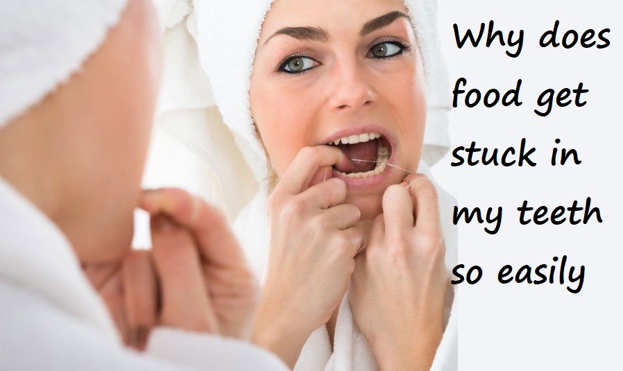 why does food get stuck in my teeth so easily