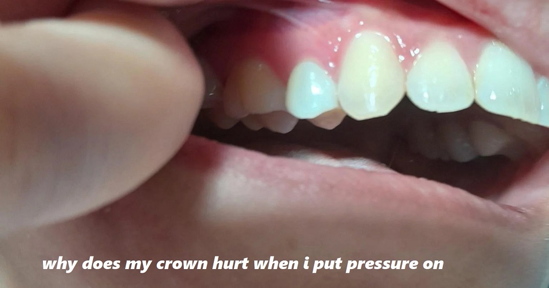 why does my crown hurt when i put pressure on