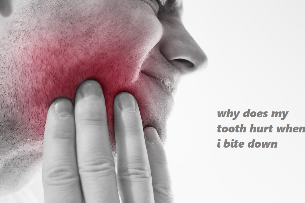 why does my tooth hurt when i bite down