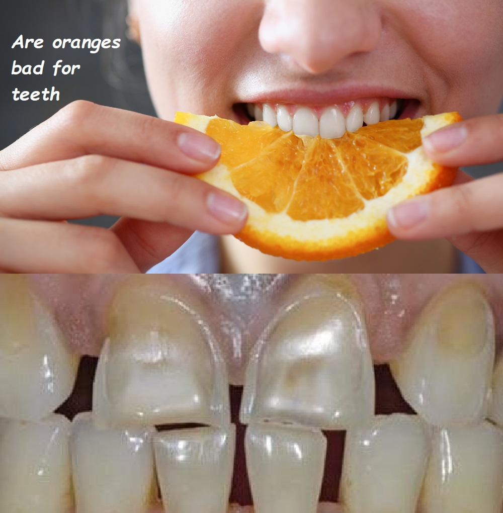 Are oranges bad for teeth