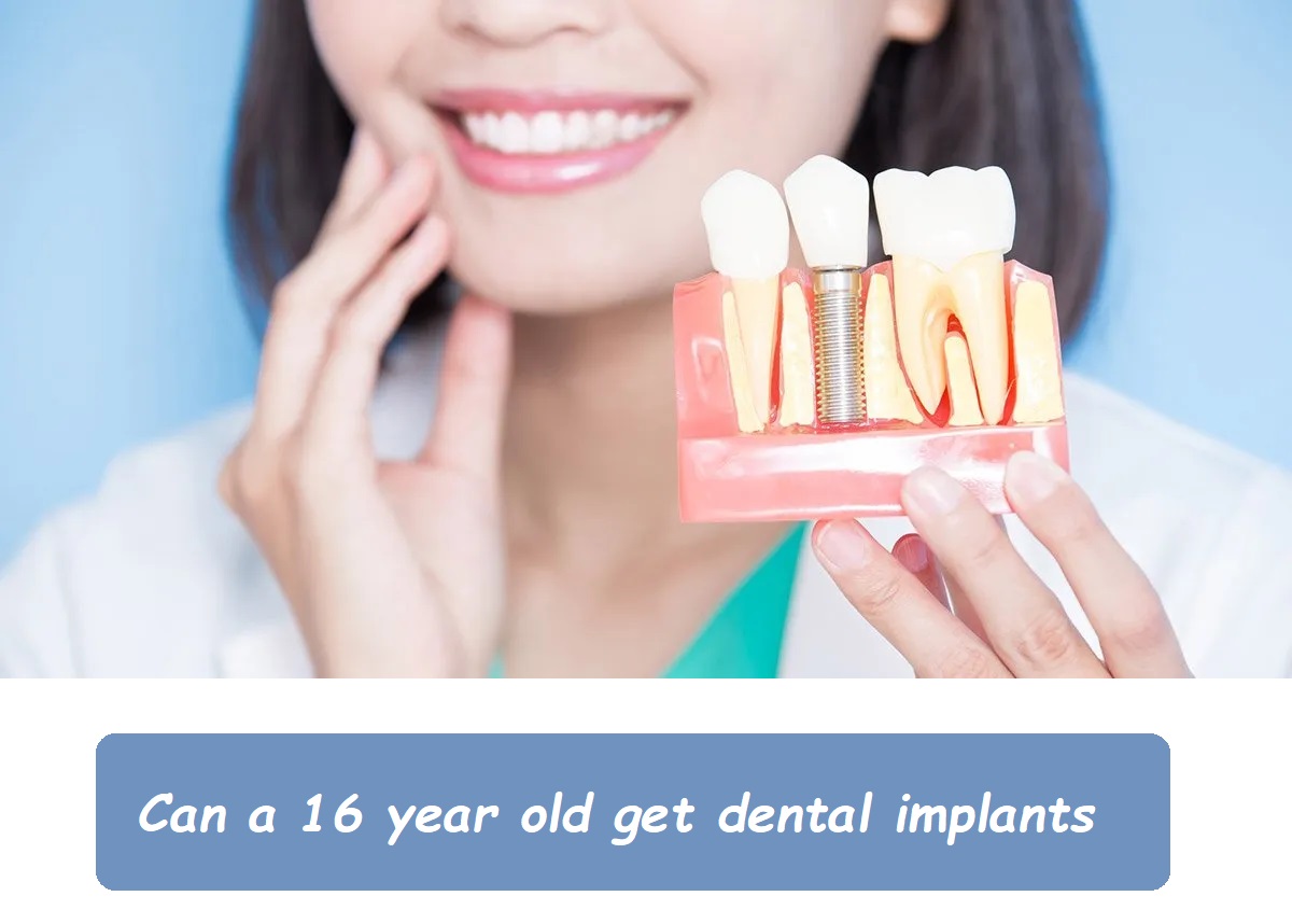 Can a 16 year old get dental implants