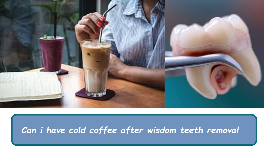 Can i have cold coffee after wisdom teeth removal