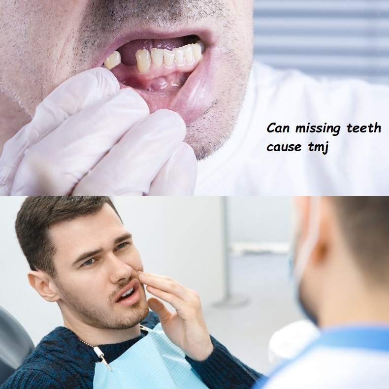 Can missing teeth cause tmj