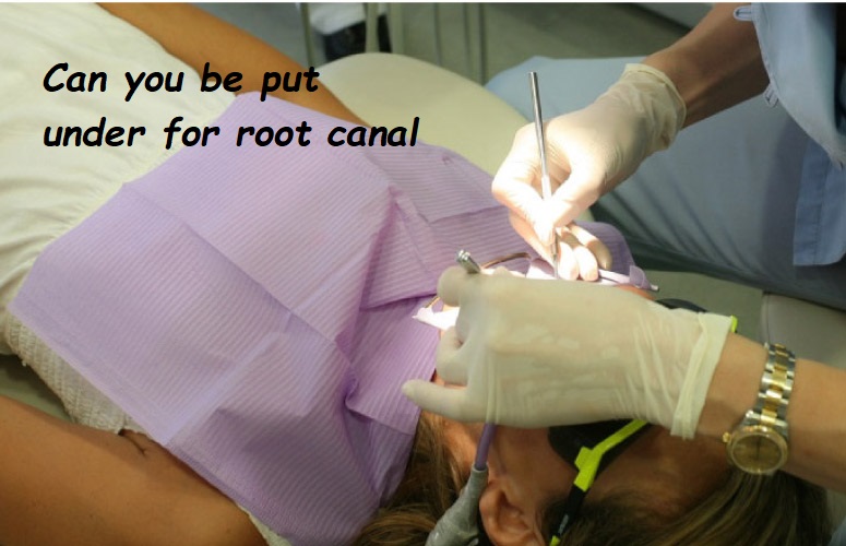 Can you be put under for root canal