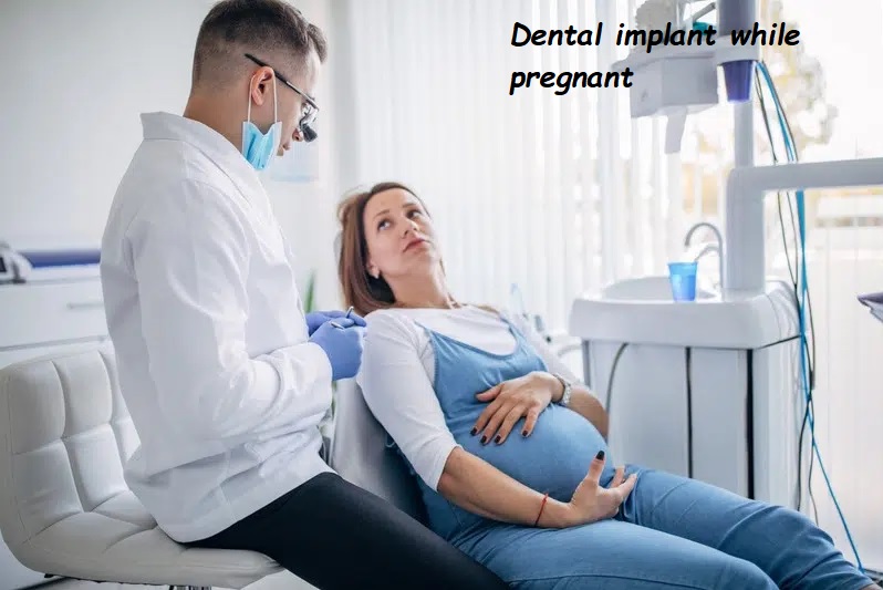 Dental implant while pregnant