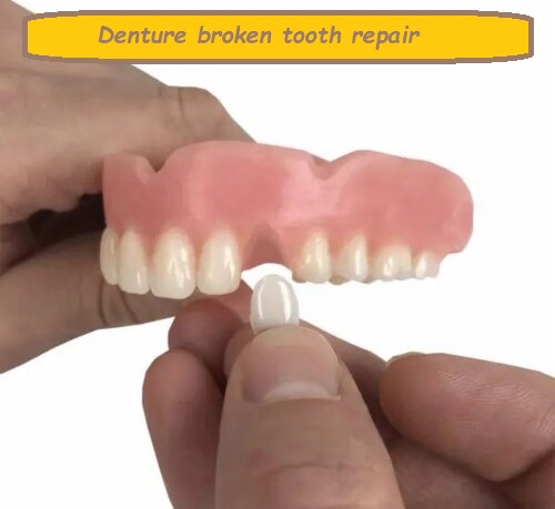 Denture broken tooth repair