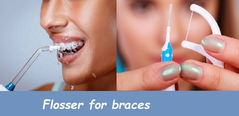 Flosser for braces