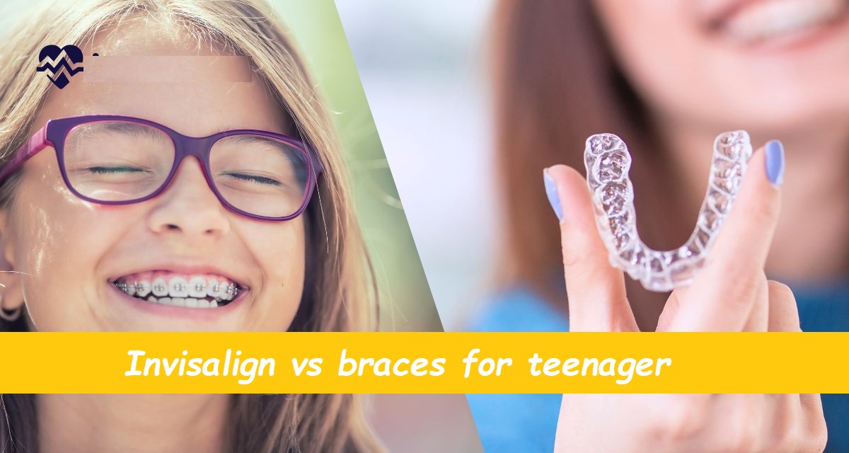 Invisalign vs braces for teenager