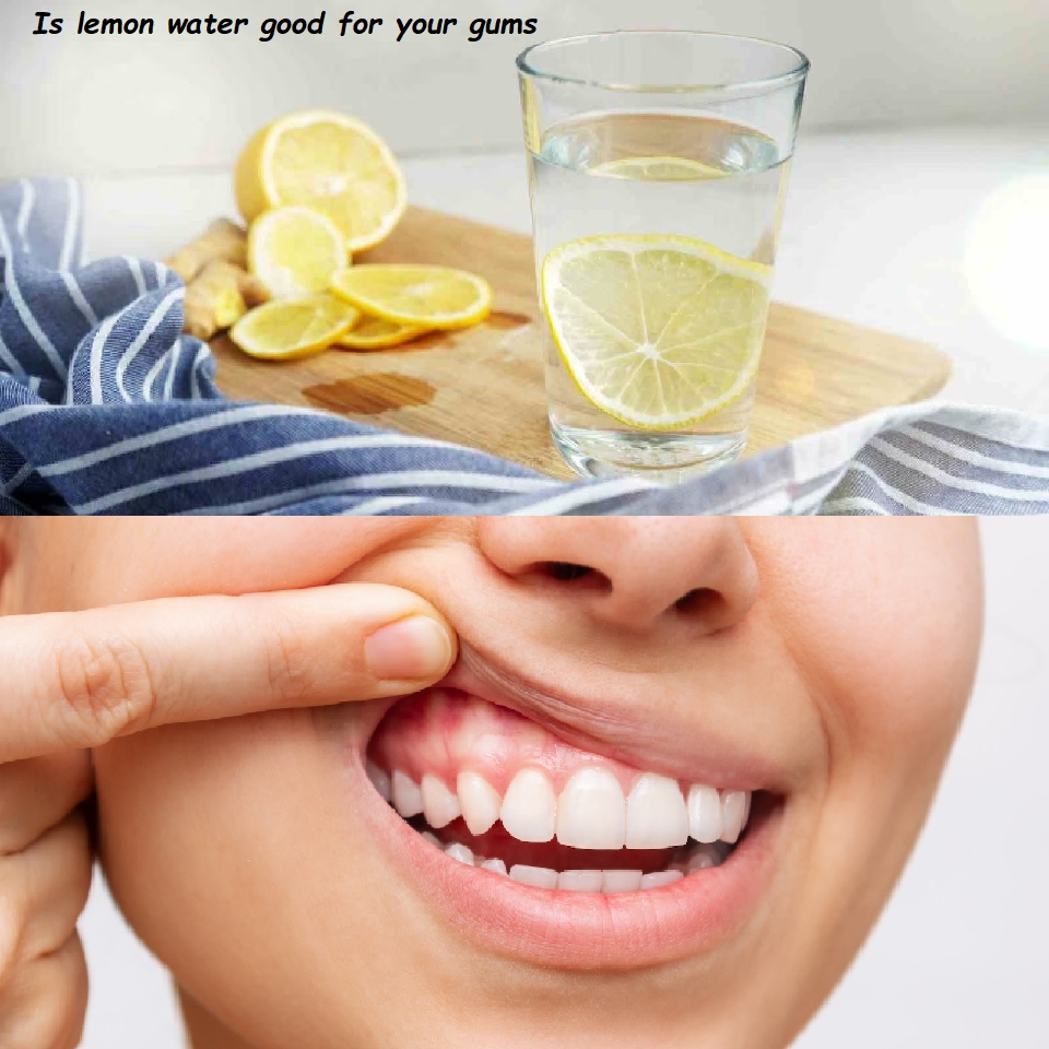 Is lemon water good for your gums