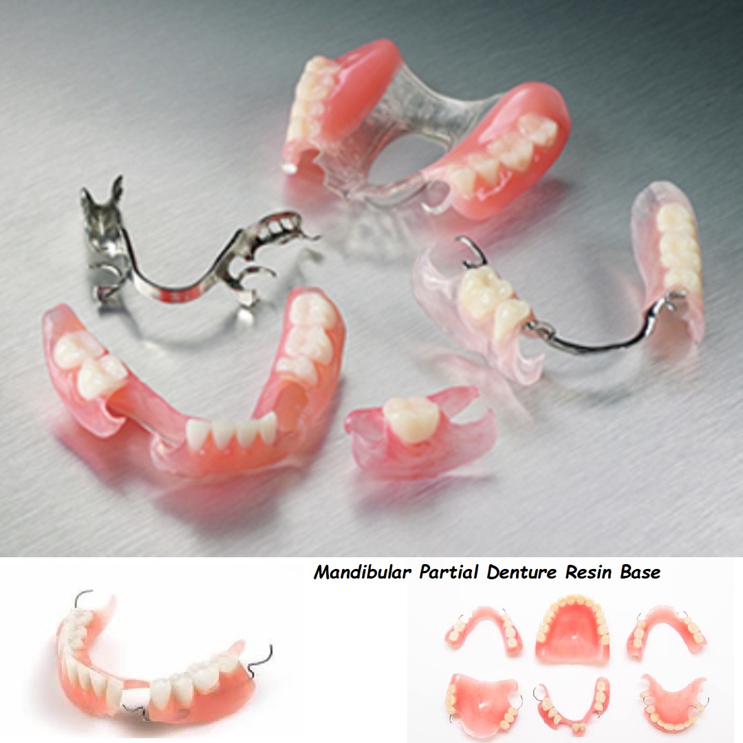 mandibular partial denture resin base