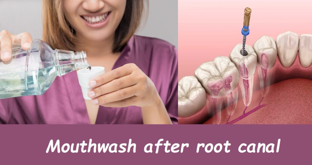 Mouthwash after root canal