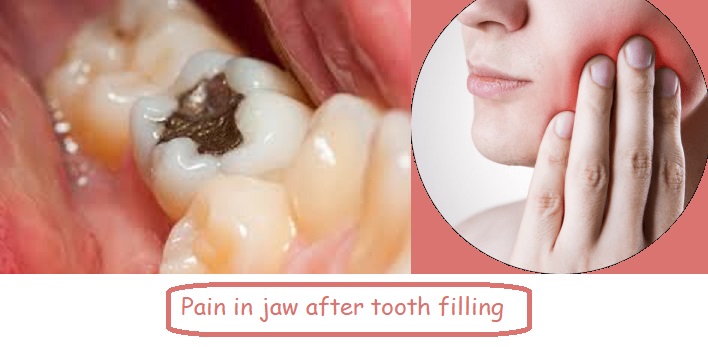 Pain in jaw after tooth filling