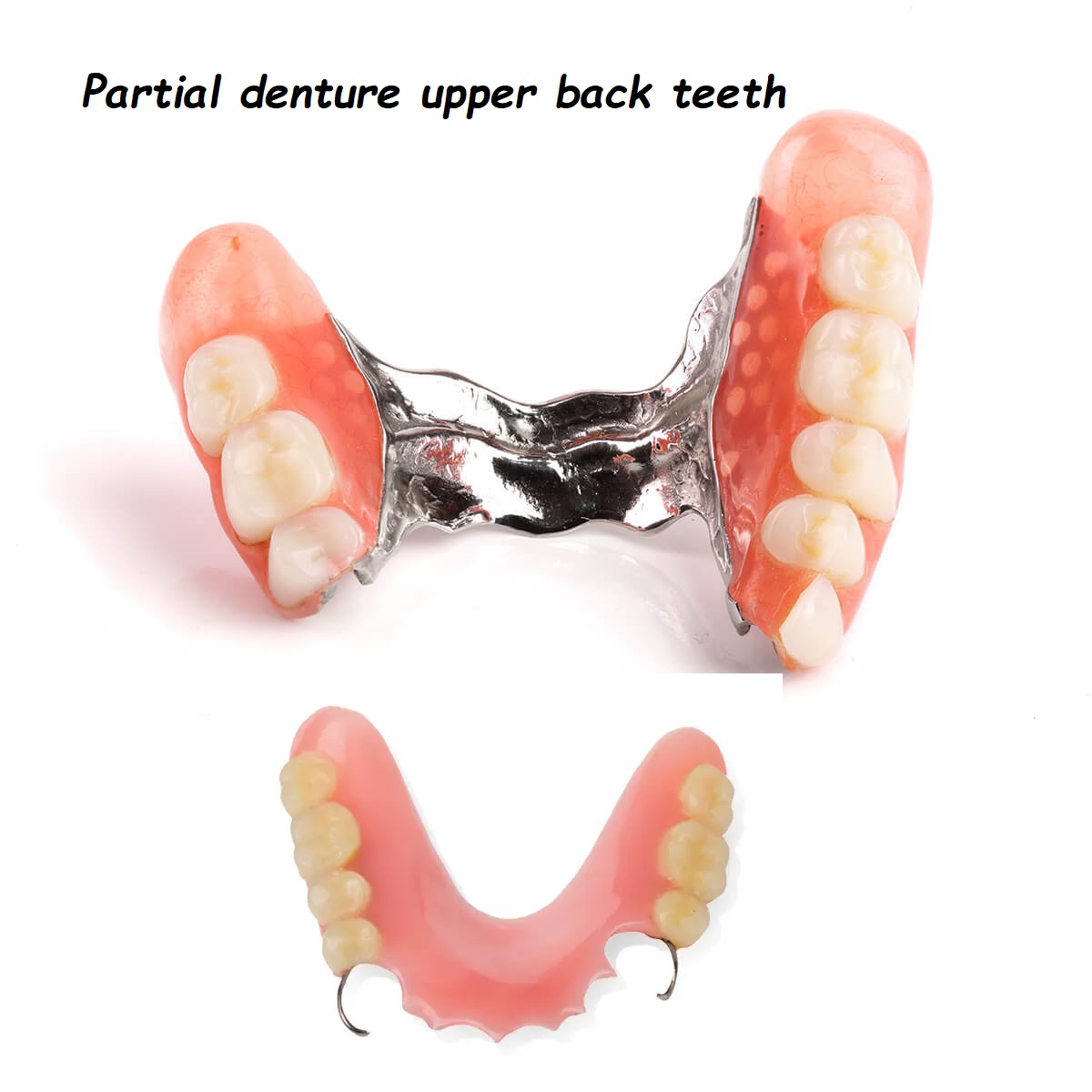 Partial denture upper back teeth