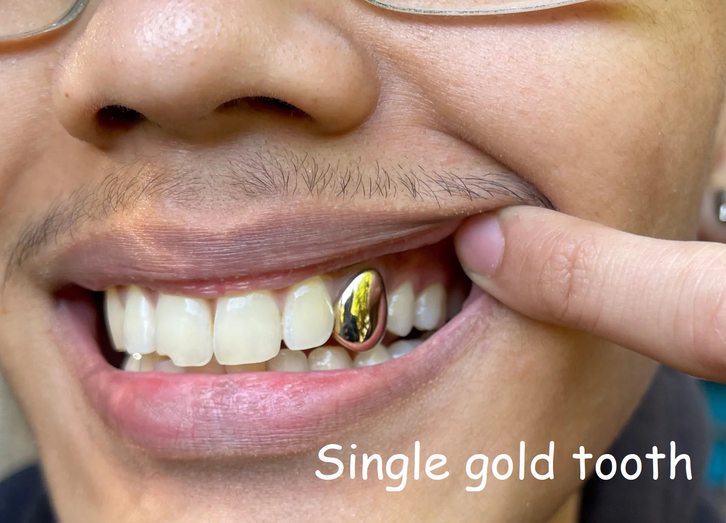 Single gold tooth