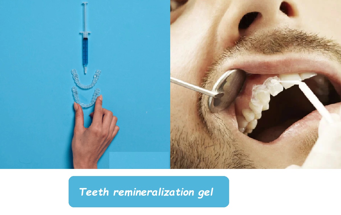 Teeth remineralization gel