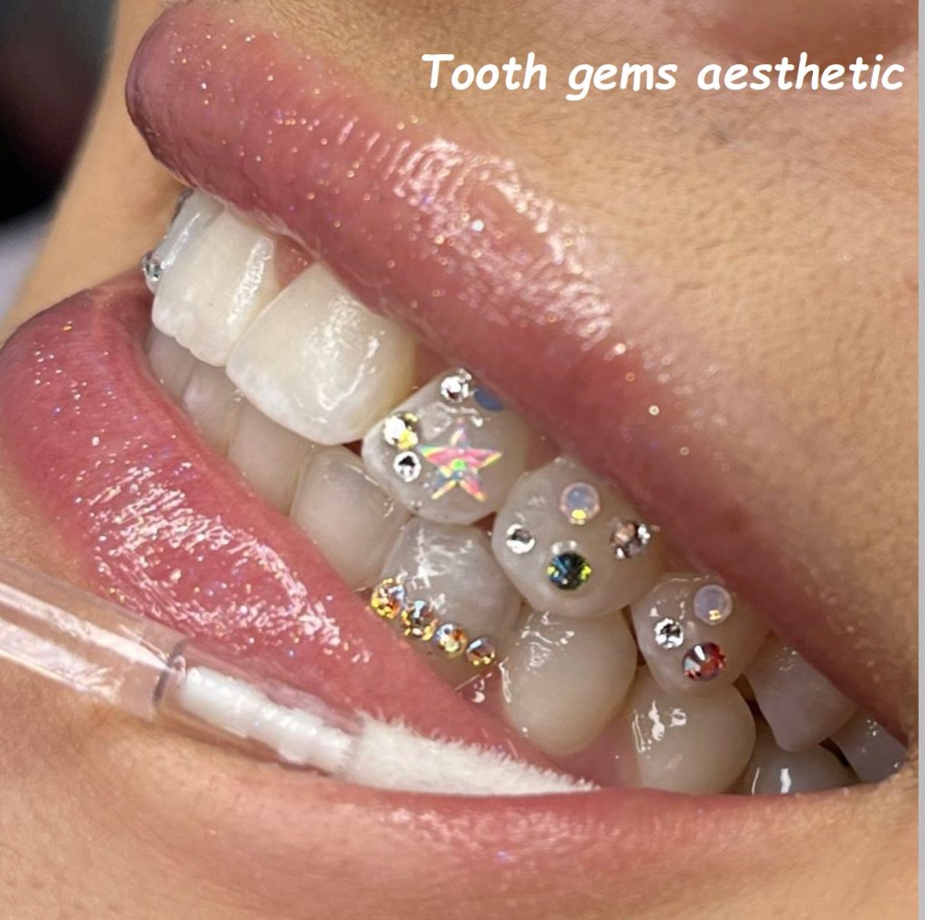 Tooth gems aesthetic