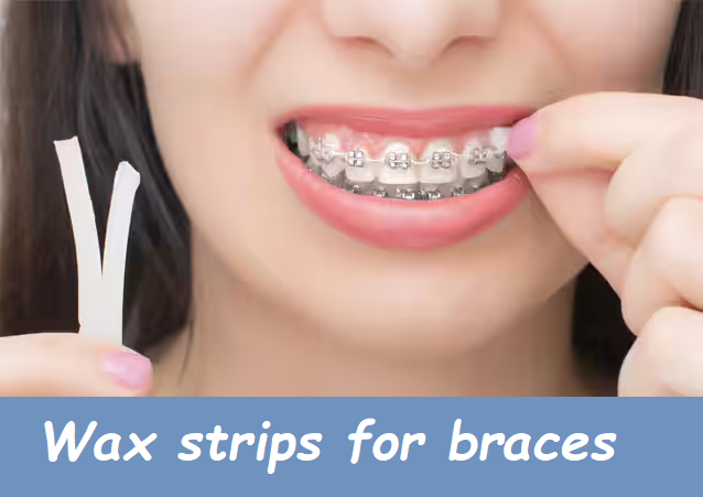 Wax strips for braces