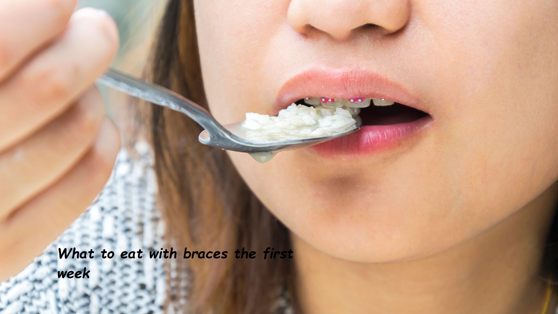 What to eat with braces the first week