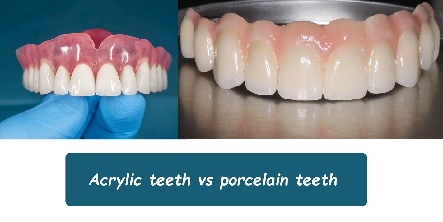 Acrylic teeth vs porcelain teeth