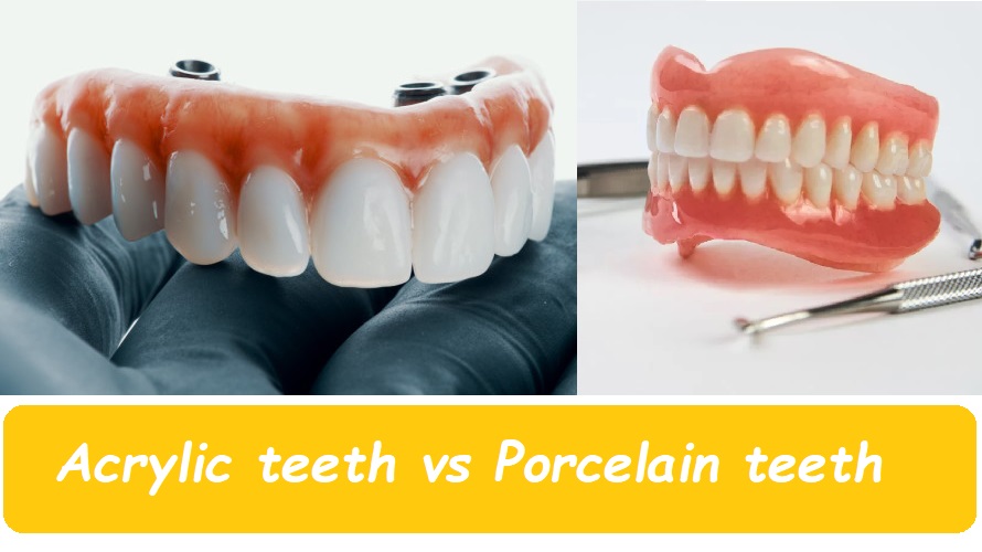 Acrylic teeth vs porcelain